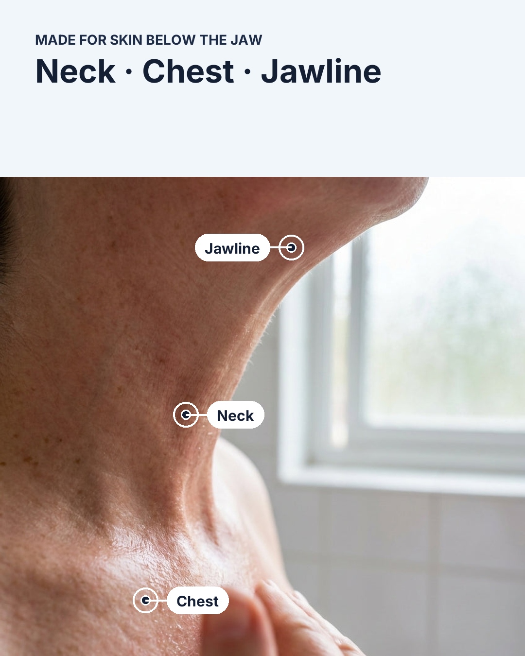 MicroSeal zones: neck, chest, jawline